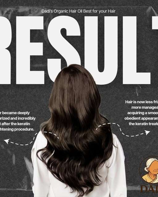 Dadi’s Organic Hair Oil Best for Hair Problems 100 ml - Image 4